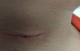 Criança de 8 anos usa caco de vidro para se cortar e parar briga dos pais